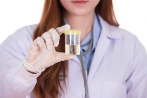 Urine sample being held by a gloved hand