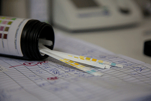 Drug testing strips on top of some papers